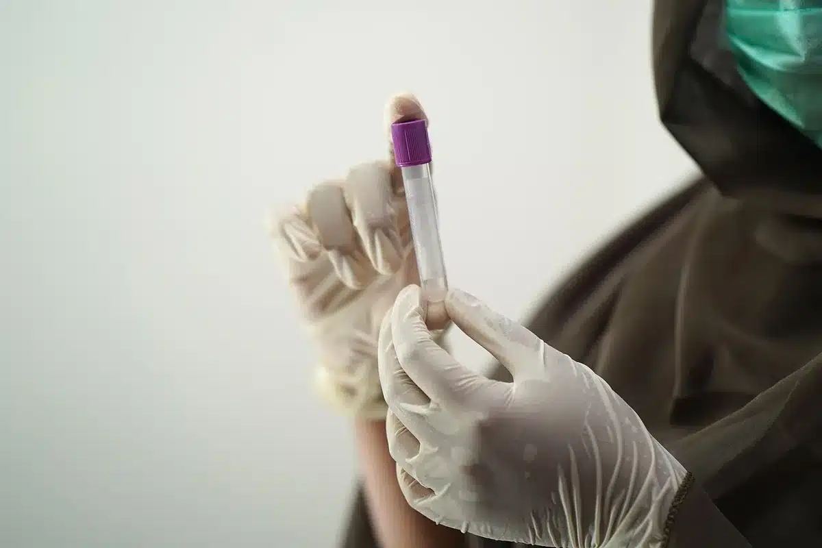 Prélèvement sanguin et flacon d'urine sur une table de consultation médicale